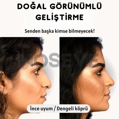 Anında Burun Kaldırma Kiti